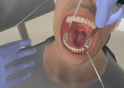 Dentiste VR